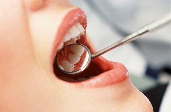 профилактика стоматологических заболеваний
