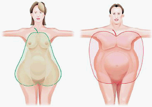 Типы и степени ожирения