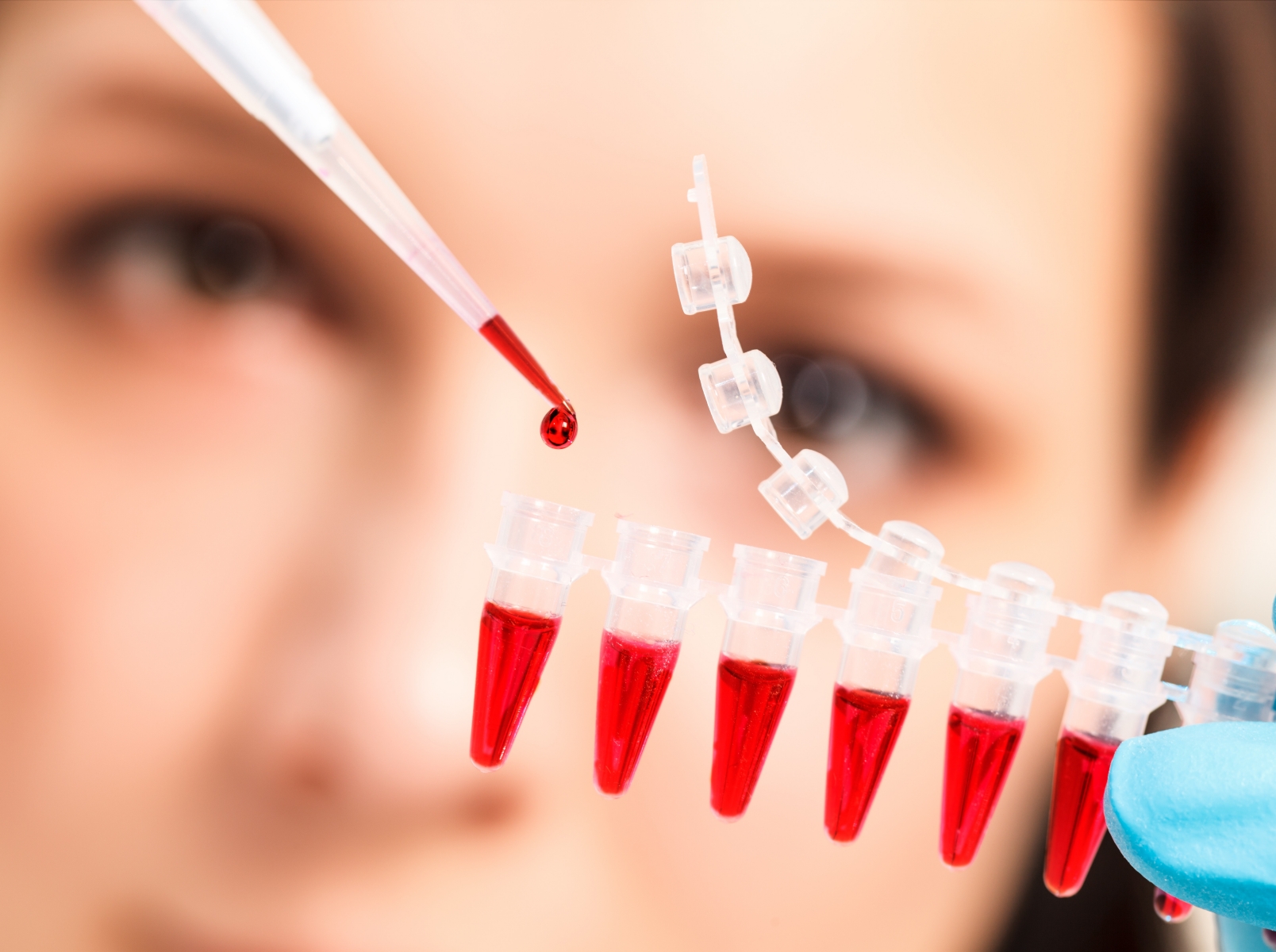 Здача крові на ПСА: суть аналізу і підготовка