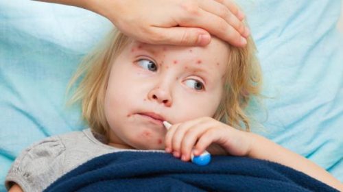 аллергия у ребёнка