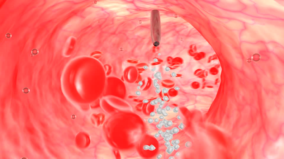 Гемоглобін в крові у чоловіків: норма і відхилення