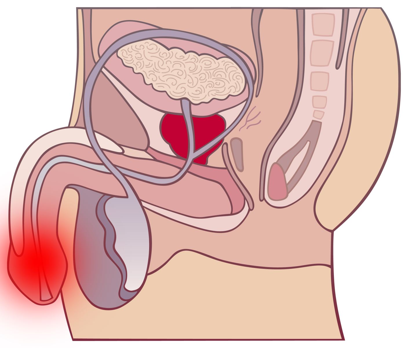 Печіння в сечовому каналі у чоловіків: при яких хворобах виникає