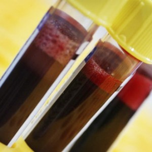 АПТВ анализ крови