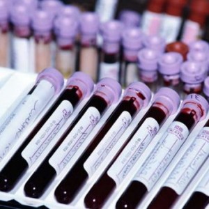 Анализ крови на гормоны