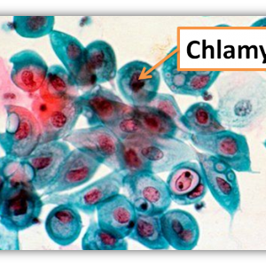 Chlamydia-Bacteria