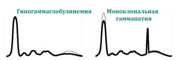 elektroforez-belkov-krovi