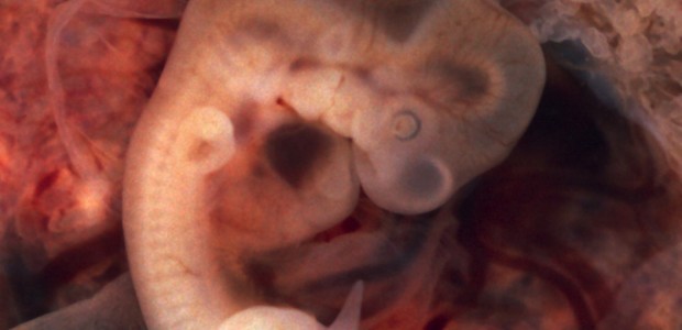 Tubal_Pregnancy_with_embryo-620x300