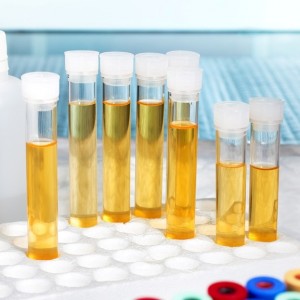 analysis of urine in lab