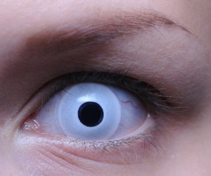 Дефект глаз – врожденный или послеоперационный – можно устранить с помощью косметических или оттеночных контактных линз