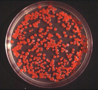 колонии Bacterium prodigiosum