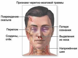 признаки травмы головы