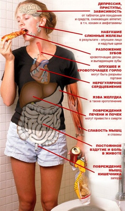 Симптомы и признаки булимии