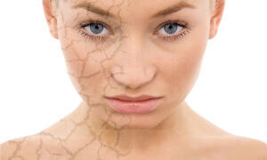 Состояние кожи лица во многом зависит от правильного рациона питания