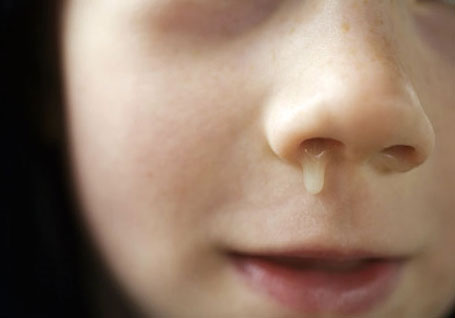 выделения из носа у ребенка при хроническом гайморите