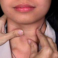 Гипоэхогенный узел щитовидной железы