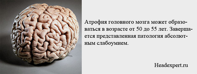 Атрофия головного мозга может образовываться в возрасте 50-55 лет