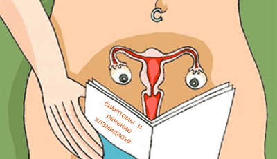 Симптомы хламидиоза у женщин