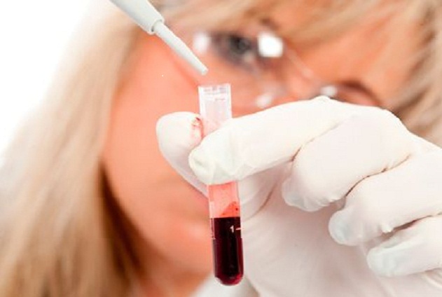 Анализ крови необходим при диагностике хронического бронхита
