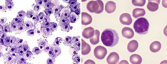 лейкоциты и лимфоциты