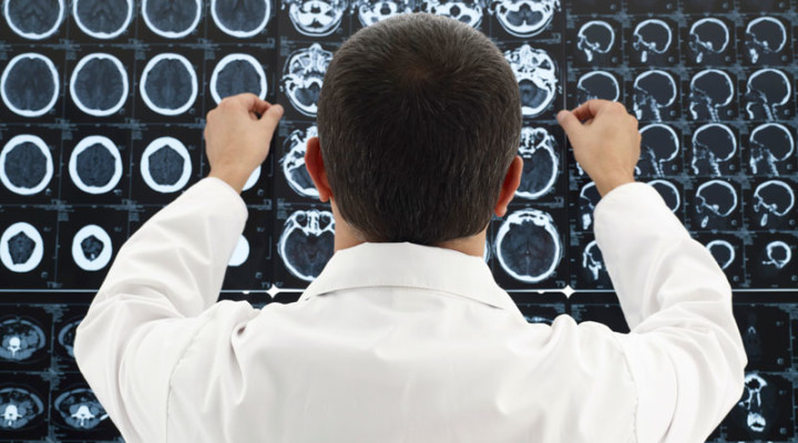 Наружная гидроцефалия головного мозга: диагностика и лечение