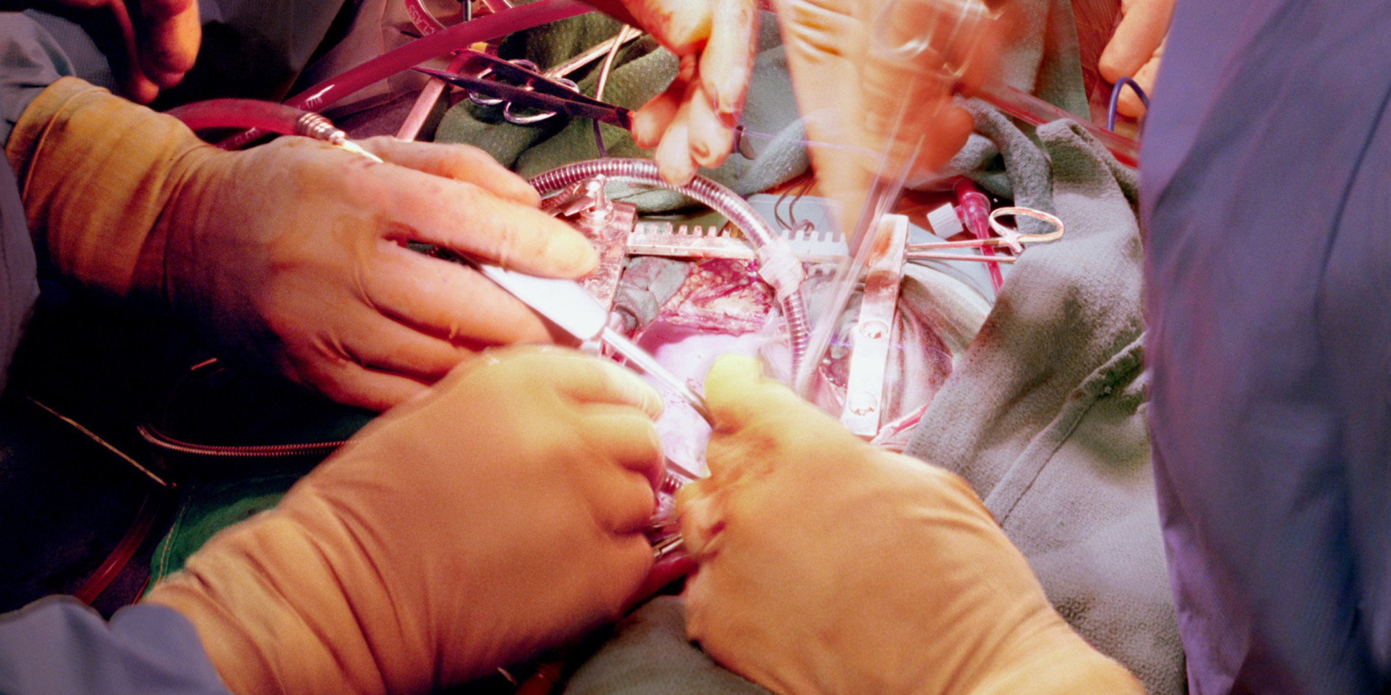 Мікрохірургічна операція варикоцеле: як проводиться