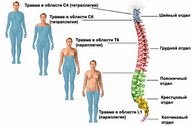 Области повреждения спинного мозга