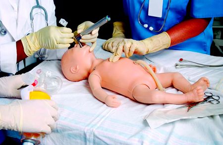 Аспирация дыхательных путей у новорожденных