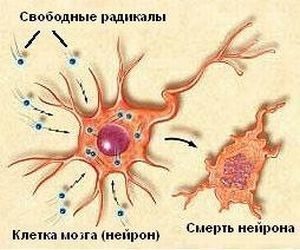 разрушенный нейрон