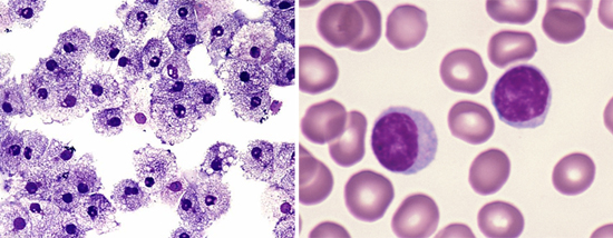 слева лейкоциты, справа - лимфоциты