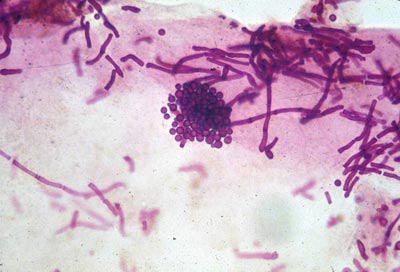 микроскопия мalassezia furfur