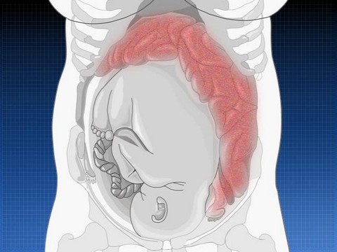 Положение кишечника при беременности