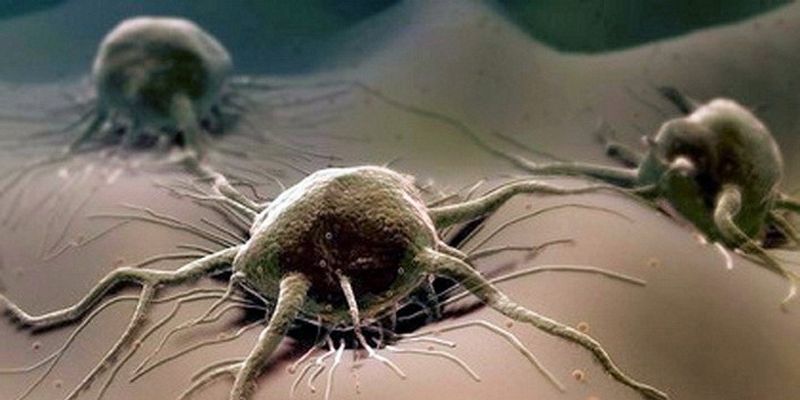 «Нещадна» онкологія або причини виникнення раку статевого члена