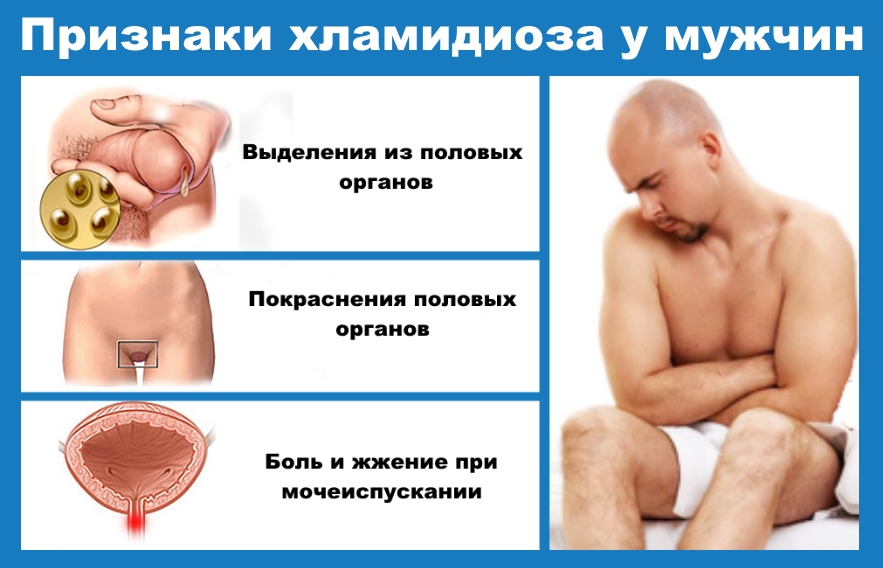 Ознаки венерологічних захворювань у чоловіків