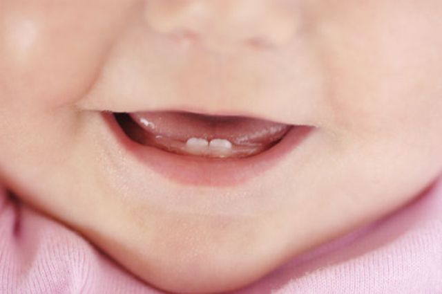 prorezivanie-zubov-u-detei1