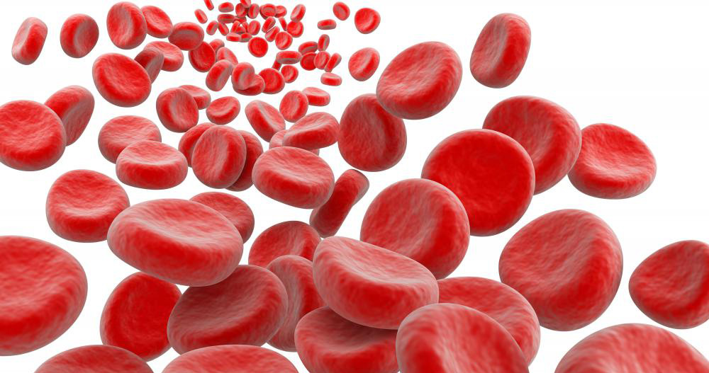 Підвищений гемоглобін: методики лікування