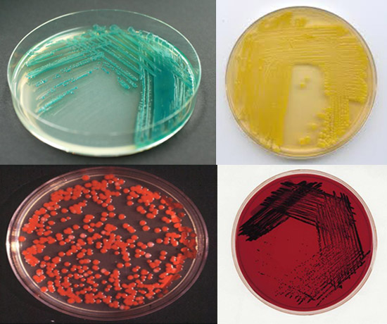  колонии бактерий