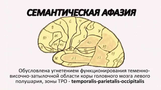 Локализация поражения в головном мозгу