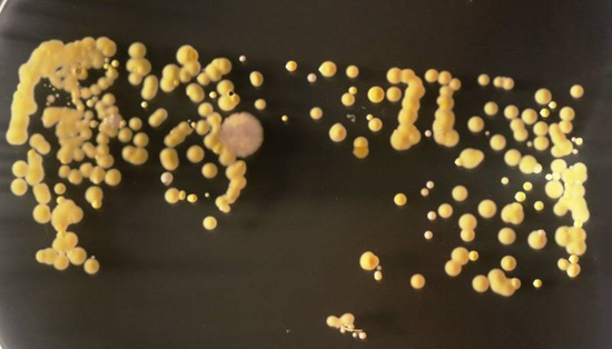 золотистые стафилококки под микроскопом