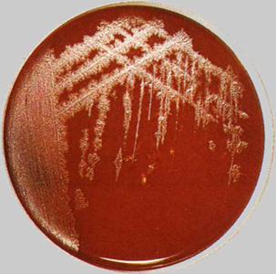 рост колоний столбнячных бактери