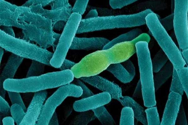 Фотография бактерии Bacillus anthracis