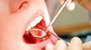 При появлении зубного камня поспешите к стоматологу