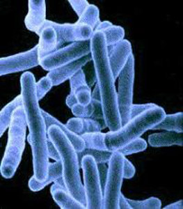 Вид туберкулезной палочки в электронном микроскопе.