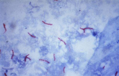 микобактерии туберкулеза 