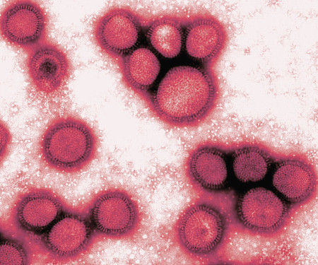 Вирус гриппа под микроскопом