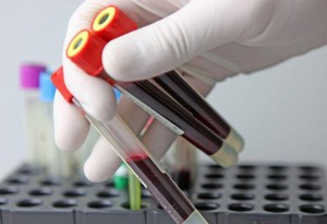 wbc лейкоциты в анализе крови