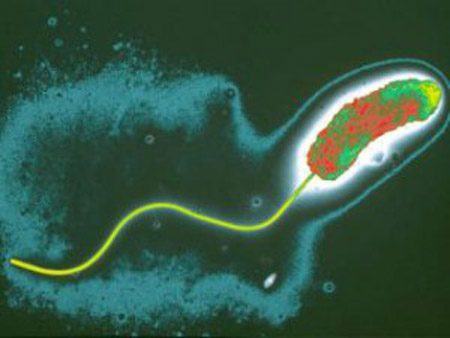 холерный вибрион